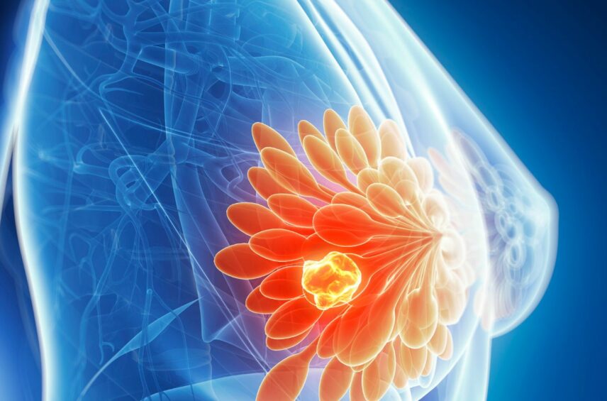 investigadores-descubren-como-actua-el-principal-gen-causante-del-cancer-de-mama-y-ovarios-hereditario
