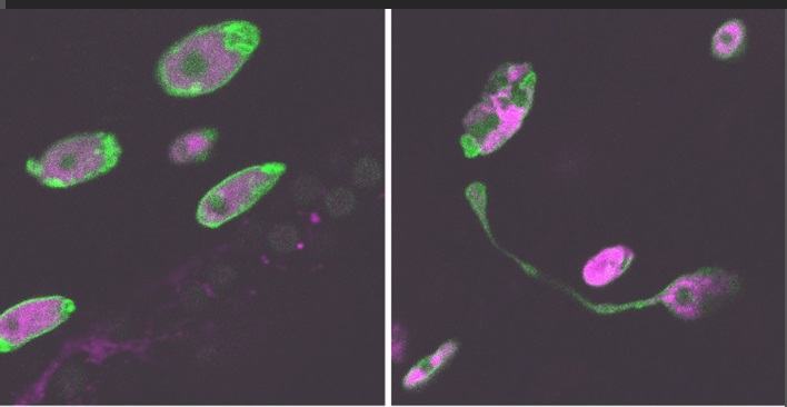 un-estudio-del-cabd-arroja-luz-sobre-la-progeria-una-enfermedad-rara-que-acelera-el-envejecimiento-prematuro