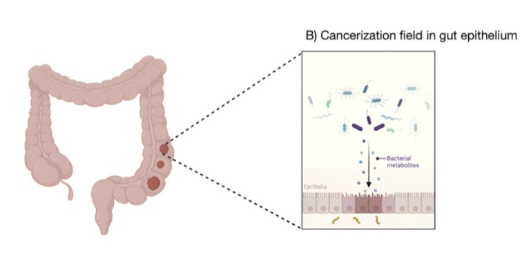 un-estudio-de-la-ugr-revela-que-la-periodontitis-podria-aumentar-el-riesgo-de-cancer-colorrectal