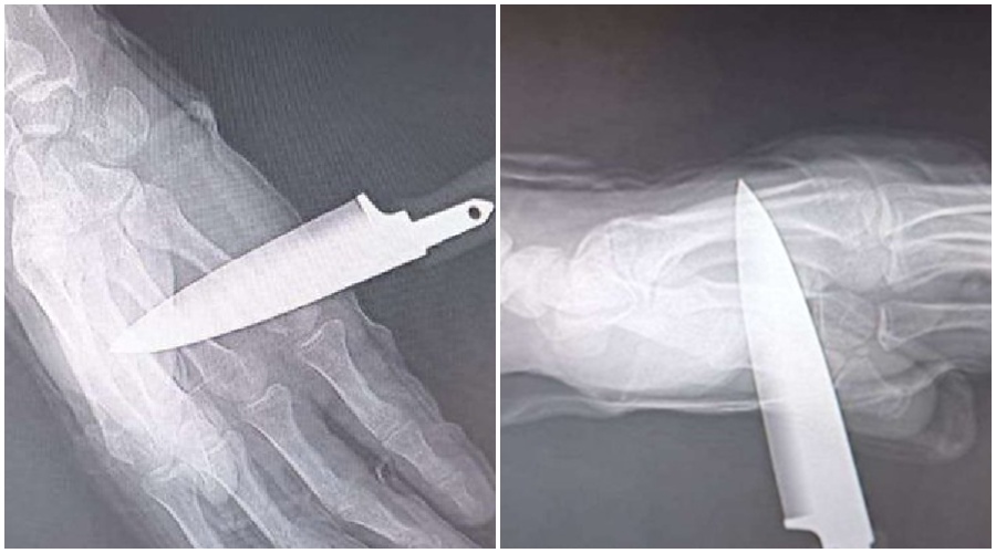 granada-apunalado-un-agente-de-la-policia-nacional-en-baza-el-chaleco-le-salva-la-vida-y-logra-detener-al-agresor-pese-a-tener-el-cuchillo-clavado-en-la-mano