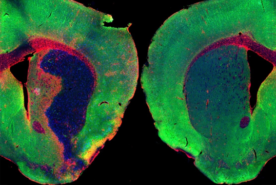 una-molecula-implicada-en-el-sueno-reduce-la-inflamacion-y-dano-cerebral-tras-un-ictus